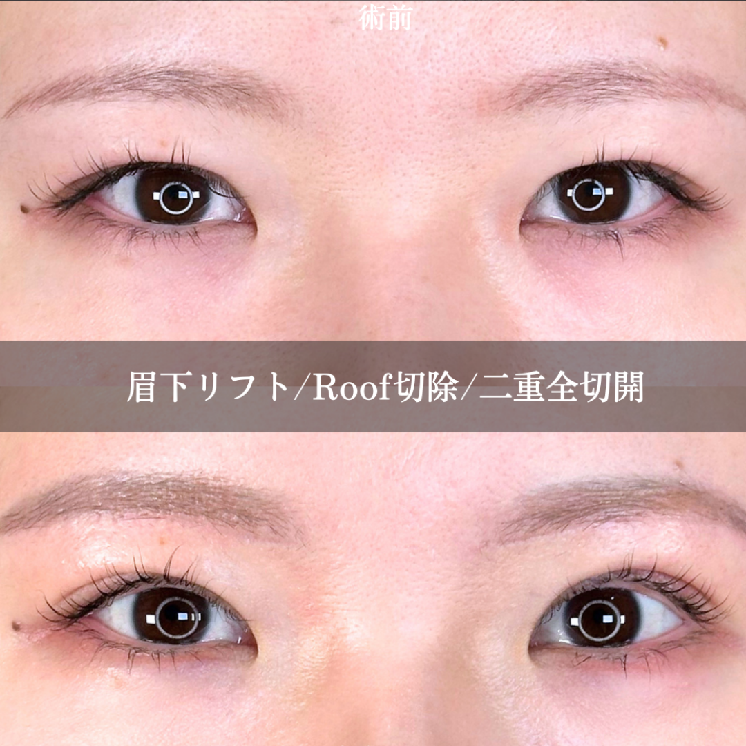 No.15769の症例写真2